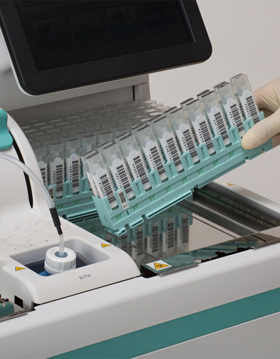 Gastrointestinal Diseases