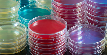 Agar plates colourful.png